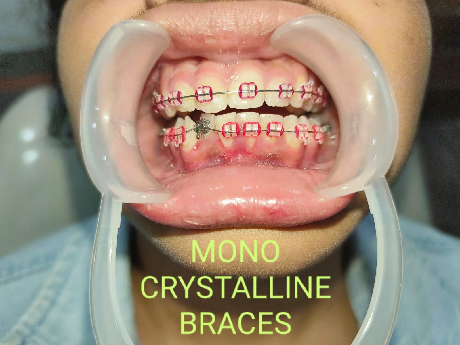 Smile Dental Care clinic photograph 9
