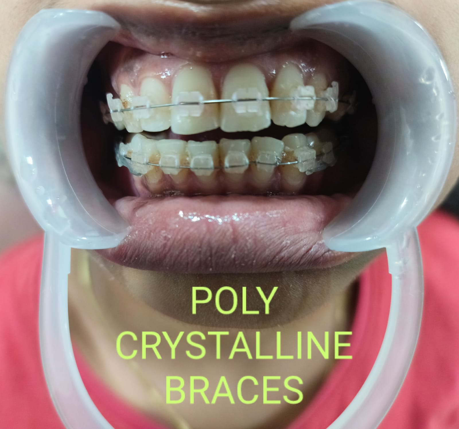Smile Dental Care clinic photograph 10