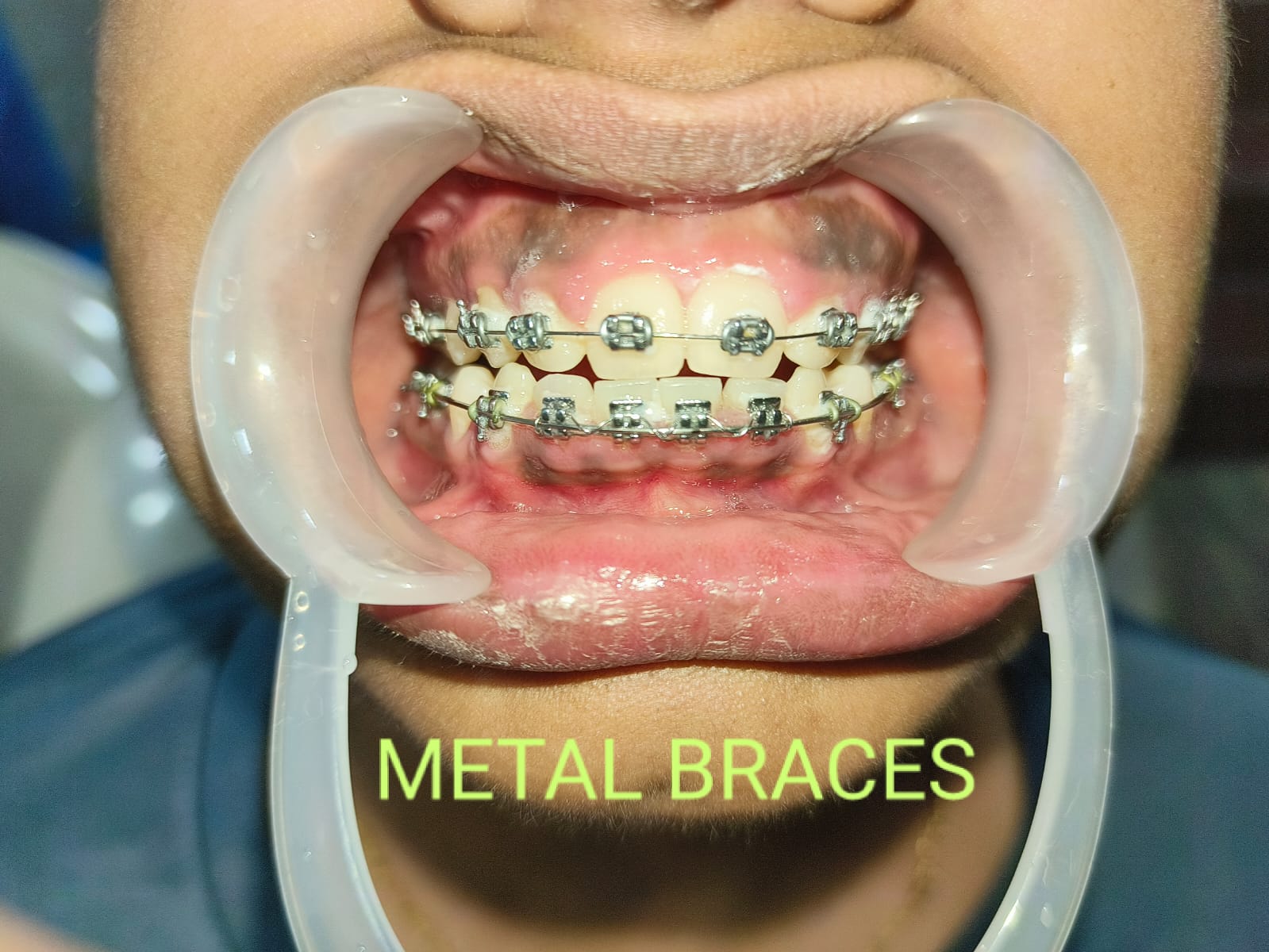 Smile Dental Care clinic photograph 11
