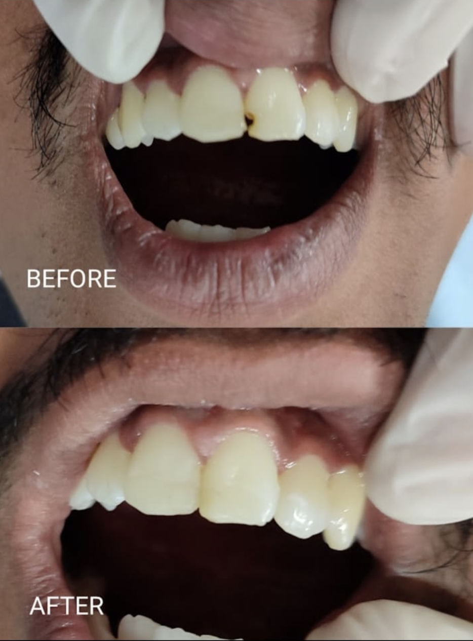 Smile Dental Care clinic photograph 14